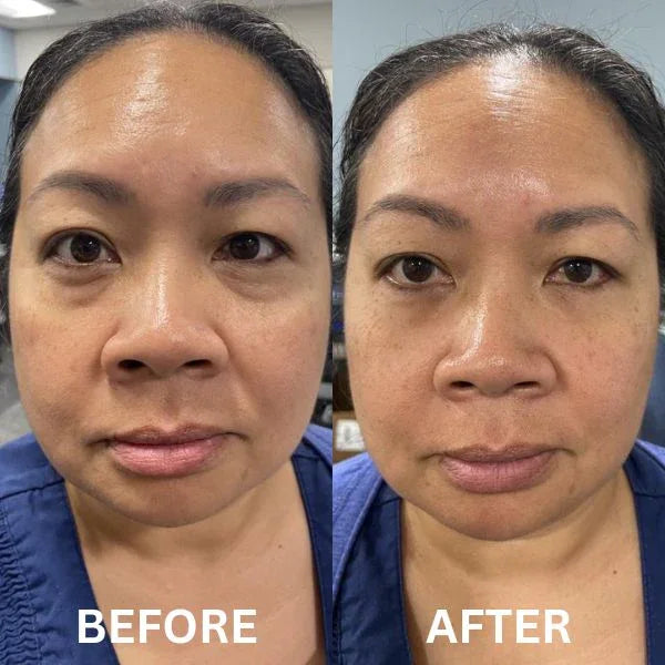 Collagen Eye Patch