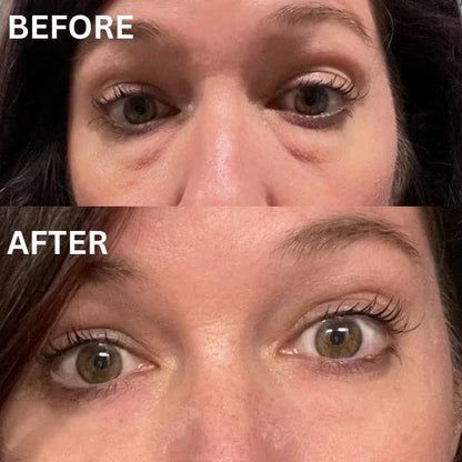 Collagen Eye Patch